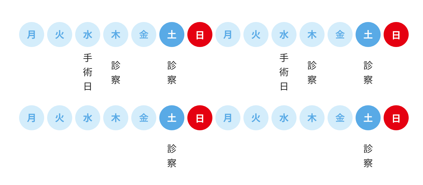 滋賀守山市の岸本眼科の白内障手術の流れのイメージ